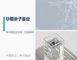 银川匿名DNA亲子鉴定采集什么样本，银川权威个人亲子鉴定机构地址在哪